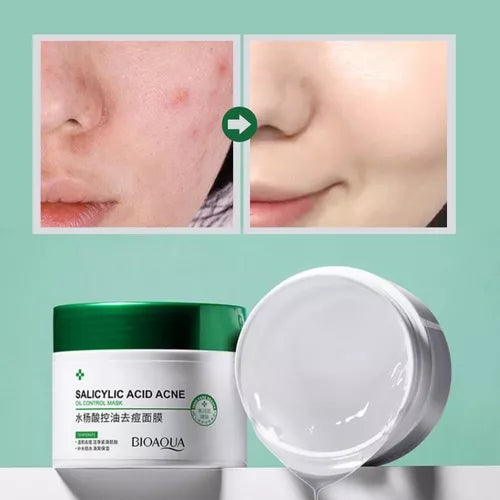( bioaqua )™ -Combo Acido Salicilico :  Piel Libre de Imperfecciones en Tiempo Récord